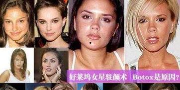 明星爆料打肉毒素视频,真实打肉毒素过程大公开